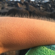 איך אומרים עור ברווז באנגלית